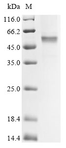 (Tris-Glycine gel) Discontinuous SDS-PAGE (reduced) with 5% enrichment gel and 15% separation gel. (Tris-Glycine gel) Discontinuous SDS-PAGE (reduced) with 5% enrichment gel and 15% separation gel.