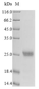 (Tris-Glycine gel) Discontinuous SDS-PAGE (reduced) with 5% enrichment gel and 15% separation gel. (Tris-Glycine gel) Discontinuous SDS-PAGE (reduced) with 5% enrichment gel and 15% separation gel.