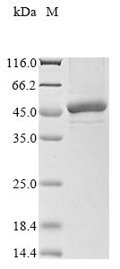 (Tris-Glycine gel) Discontinuous SDS-PAGE (reduced) with 5% enrichment gel and 15% separation gel. (Tris-Glycine gel) Discontinuous SDS-PAGE (reduced) with 5% enrichment gel and 15% separation gel.