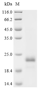 Recombinant Chlamydia pneumoniae Large cysteine-rich periplasmic protein OmcB (omcB) , partial - image 1