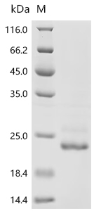 Recombinant Chlamydia pneumoniae Large cysteine-rich periplasmic protein OmcB (omcB) , partial - image 1