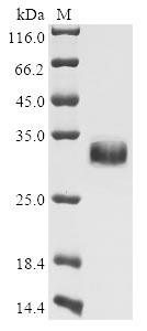 (Tris-Glycine gel) Discontinuous SDS-PAGE (reduced) with 5% enrichment gel and 15% separation gel. (Tris-Glycine gel) Discontinuous SDS-PAGE (reduced) with 5% enrichment gel and 15% separation gel.