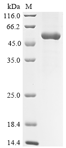 (Tris-Glycine gel) Discontinuous SDS-PAGE (reduced) with 5% enrichment gel and 15% separation gel. (Tris-Glycine gel) Discontinuous SDS-PAGE (reduced) with 5% enrichment gel and 15% separation gel.