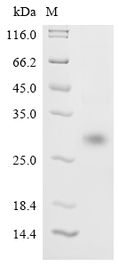 (Tris-Glycine gel) Discontinuous SDS-PAGE (reduced) with 5% enrichment gel and 15% separation gel. (Tris-Glycine gel) Discontinuous SDS-PAGE (reduced) with 5% enrichment gel and 15% separation gel.
