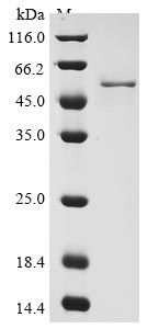 (Tris-Glycine gel) Discontinuous SDS-PAGE (reduced) with 5% enrichment gel and 15% separation gel. (Tris-Glycine gel) Discontinuous SDS-PAGE (reduced) with 5% enrichment gel and 15% separation gel.