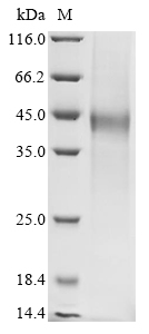 (Tris-Glycine gel) Discontinuous SDS-PAGE (reduced) with 5% enrichment gel and 15% separation gel.