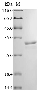 (Tris-Glycine gel) Discontinuous SDS-PAGE (reduced) with 5% enrichment gel and 15% separation gel. (Tris-Glycine gel) Discontinuous SDS-PAGE (reduced) with 5% enrichment gel and 15% separation gel.