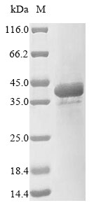 (Tris-Glycine gel) Discontinuous SDS-PAGE (reduced) with 5% enrichment gel and 15% separation gel.