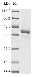 (Tris-Glycine gel) Discontinuous SDS-PAGE (reduced) with 5% enrichment gel and 15% separation gel.