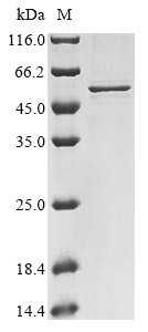(Tris-Glycine gel) Discontinuous SDS-PAGE (reduced) with 5% enrichment gel and 15% separation gel. (Tris-Glycine gel) Discontinuous SDS-PAGE (reduced) with 5% enrichment gel and 15% separation gel.