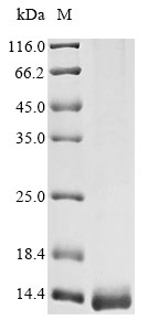 Recombinant Tityus bahiensis Toxin Tb2-II - image 1