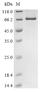 (Tris-Glycine gel) Discontinuous SDS-PAGE (reduced) with 5% enrichment gel and 15% separation gel. (Tris-Glycine gel) Discontinuous SDS-PAGE (reduced) with 5% enrichment gel and 15% separation gel.