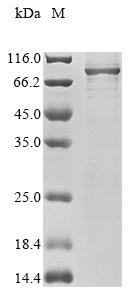 (Tris-Glycine gel) Discontinuous SDS-PAGE (reduced) with 5% enrichment gel and 15% separation gel. (Tris-Glycine gel) Discontinuous SDS-PAGE (reduced) with 5% enrichment gel and 15% separation gel.