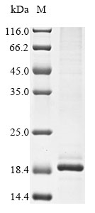 (Tris-Glycine gel) Discontinuous SDS-PAGE (reduced) with 5% enrichment gel and 15% separation gel. (Tris-Glycine gel) Discontinuous SDS-PAGE (reduced) with 5% enrichment gel and 15% separation gel.
