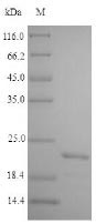 (Tris-Glycine gel) Discontinuous SDS-PAGE (reduced) with 5% enrichment gel and 15% separation gel. (Tris-Glycine gel) Discontinuous SDS-PAGE (reduced) with 5% enrichment gel and 15% separation gel.