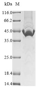 (Tris-Glycine gel) Discontinuous SDS-PAGE (reduced) with 5% enrichment gel and 15% separation gel. (Tris-Glycine gel) Discontinuous SDS-PAGE (reduced) with 5% enrichment gel and 15% separation gel.