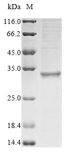 (Tris-Glycine gel) Discontinuous SDS-PAGE (reduced) with 5% enrichment gel and 15% separation gel. (Tris-Glycine gel) Discontinuous SDS-PAGE (reduced) with 5% enrichment gel and 15% separation gel.
