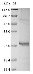 (Tris-Glycine gel) Discontinuous SDS-PAGE (reduced) with 5% enrichment gel and 15% separation gel. (Tris-Glycine gel) Discontinuous SDS-PAGE (reduced) with 5% enrichment gel and 15% separation gel.