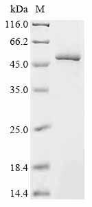 (Tris-Glycine gel) Discontinuous SDS-PAGE (reduced) with 5% enrichment gel and 15% separation gel. (Tris-Glycine gel) Discontinuous SDS-PAGE (reduced) with 5% enrichment gel and 15% separation gel.