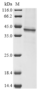 (Tris-Glycine gel) Discontinuous SDS-PAGE (reduced) with 5% enrichment gel and 15% separation gel. (Tris-Glycine gel) Discontinuous SDS-PAGE (reduced) with 5% enrichment gel and 15% separation gel.