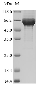 (Tris-Glycine gel) Discontinuous SDS-PAGE (reduced) with 5% enrichment gel and 15% separation gel. (Tris-Glycine gel) Discontinuous SDS-PAGE (reduced) with 5% enrichment gel and 15% separation gel.