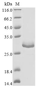 (Tris-Glycine gel) Discontinuous SDS-PAGE (reduced) with 5% enrichment gel and 15% separation gel. (Tris-Glycine gel) Discontinuous SDS-PAGE (reduced) with 5% enrichment gel and 15% separation gel.