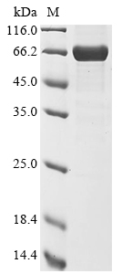 (Tris-Glycine gel) Discontinuous SDS-PAGE (reduced) with 5% enrichment gel and 15% separation gel. (Tris-Glycine gel) Discontinuous SDS-PAGE (reduced) with 5% enrichment gel and 15% separation gel.