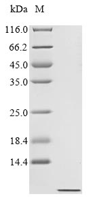 (Tris-Glycine gel) Discontinuous SDS-PAGE (reduced) with 5% enrichment gel and 15% separation gel. (Tris-Glycine gel) Discontinuous SDS-PAGE (reduced) with 5% enrichment gel and 15% separation gel.