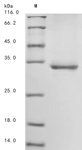 (Tris-Glycine gel) Discontinuous SDS-PAGE (reduced) with 5% enrichment gel and 15% separation gel. (Tris-Glycine gel) Discontinuous SDS-PAGE (reduced) with 5% enrichment gel and 15% separation gel.