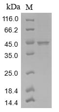 (Tris-Glycine gel) Discontinuous SDS-PAGE (reduced) with 5% enrichment gel and 15% separation gel. (Tris-Glycine gel) Discontinuous SDS-PAGE (reduced) with 5% enrichment gel and 15% separation gel.
