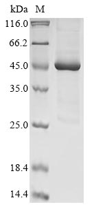 (Tris-Glycine gel) Discontinuous SDS-PAGE (reduced) with 5% enrichment gel and 15% separation gel.