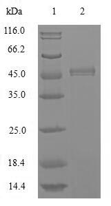 (Tris-Glycine gel) Discontinuous SDS-PAGE (reduced) with 5% enrichment gel and 15% separation gel. (Tris-Glycine gel) Discontinuous SDS-PAGE (reduced) with 5% enrichment gel and 15% separation gel.