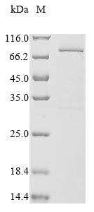 (Tris-Glycine gel) Discontinuous SDS-PAGE (reduced) with 5% enrichment gel and 15% separation gel. (Tris-Glycine gel) Discontinuous SDS-PAGE (reduced) with 5% enrichment gel and 15% separation gel.