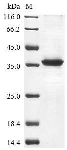 (Tris-Glycine gel) Discontinuous SDS-PAGE (reduced) with 5% enrichment gel and 15% separation gel. (Tris-Glycine gel) Discontinuous SDS-PAGE (reduced) with 5% enrichment gel and 15% separation gel.