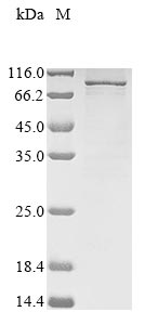 (Tris-Glycine gel) Discontinuous SDS-PAGE (reduced) with 5% enrichment gel and 15% separation gel. (Tris-Glycine gel) Discontinuous SDS-PAGE (reduced) with 5% enrichment gel and 15% separation gel.
