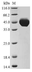 (Tris-Glycine gel) Discontinuous SDS-PAGE (reduced) with 5% enrichment gel and 15% separation gel. (Tris-Glycine gel) Discontinuous SDS-PAGE (reduced) with 5% enrichment gel and 15% separation gel.