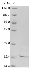 (Tris-Glycine gel) Discontinuous SDS-PAGE (reduced) with 5% enrichment gel and 15% separation gel. (Tris-Glycine gel) Discontinuous SDS-PAGE (reduced) with 5% enrichment gel and 15% separation gel.