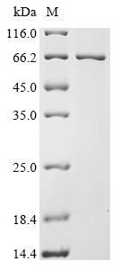 Recombinant Human Retinoid isomerohydrolase (RPE65) - image 1