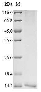 (Tris-Glycine gel) Discontinuous SDS-PAGE (reduced) with 5% enrichment gel and 15% separation gel. (Tris-Glycine gel) Discontinuous SDS-PAGE (reduced) with 5% enrichment gel and 15% separation gel.