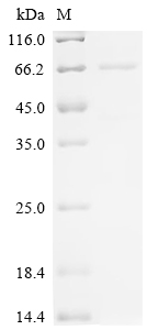 Recombinant Mouse Putative phospholipase B-like 2 (Plbd2) - image 1