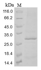 (Tris-Glycine gel) Discontinuous SDS-PAGE (reduced) with 5% enrichment gel and 15% separation gel. (Tris-Glycine gel) Discontinuous SDS-PAGE (reduced) with 5% enrichment gel and 15% separation gel.
