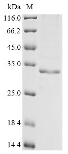 (Tris-Glycine gel) Discontinuous SDS-PAGE (reduced) with 5% enrichment gel and 15% separation gel. (Tris-Glycine gel) Discontinuous SDS-PAGE (reduced) with 5% enrichment gel and 15% separation gel.