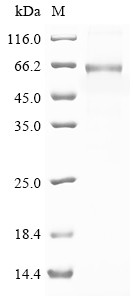 (Tris-Glycine gel) Discontinuous SDS-PAGE (reduced) with 5% enrichment gel and 15% separation gel. (Tris-Glycine gel) Discontinuous SDS-PAGE (reduced) with 5% enrichment gel and 15% separation gel.