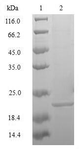 (Tris-Glycine gel) Discontinuous SDS-PAGE (reduced) with 5% enrichment gel and 15% separation gel. (Tris-Glycine gel) Discontinuous SDS-PAGE (reduced) with 5% enrichment gel and 15% separation gel.