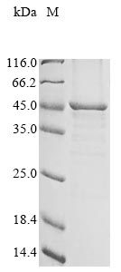 (Tris-Glycine gel) Discontinuous SDS-PAGE (reduced) with 5% enrichment gel and 15% separation gel. (Tris-Glycine gel) Discontinuous SDS-PAGE (reduced) with 5% enrichment gel and 15% separation gel.