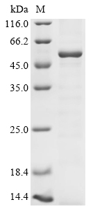 (Tris-Glycine gel) Discontinuous SDS-PAGE (reduced) with 5% enrichment gel and 15% separation gel. (Tris-Glycine gel) Discontinuous SDS-PAGE (reduced) with 5% enrichment gel and 15% separation gel.