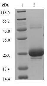 (Tris-Glycine gel) Discontinuous SDS-PAGE (reduced) with 5% enrichment gel and 15% separation gel. (Tris-Glycine gel) Discontinuous SDS-PAGE (reduced) with 5% enrichment gel and 15% separation gel.