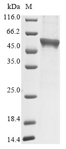 (Tris-Glycine gel) Discontinuous SDS-PAGE (reduced) with 5% enrichment gel and 15% separation gel. (Tris-Glycine gel) Discontinuous SDS-PAGE (reduced) with 5% enrichment gel and 15% separation gel.