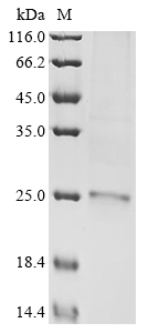 (Tris-Glycine gel) Discontinuous SDS-PAGE (reduced) with 5% enrichment gel and 15% separation gel. (Tris-Glycine gel) Discontinuous SDS-PAGE (reduced) with 5% enrichment gel and 15% separation gel.