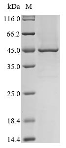 (Tris-Glycine gel) Discontinuous SDS-PAGE (reduced) with 5% enrichment gel and 15% separation gel. (Tris-Glycine gel) Discontinuous SDS-PAGE (reduced) with 5% enrichment gel and 15% separation gel.